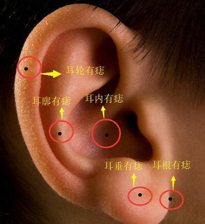 耳朵裡面長痣|耳朵长痣的位置图解 耳朵长痣的位置图解有福气